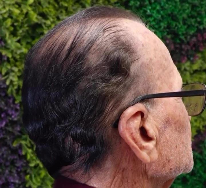 Cubrimiento y transición de cana profesional