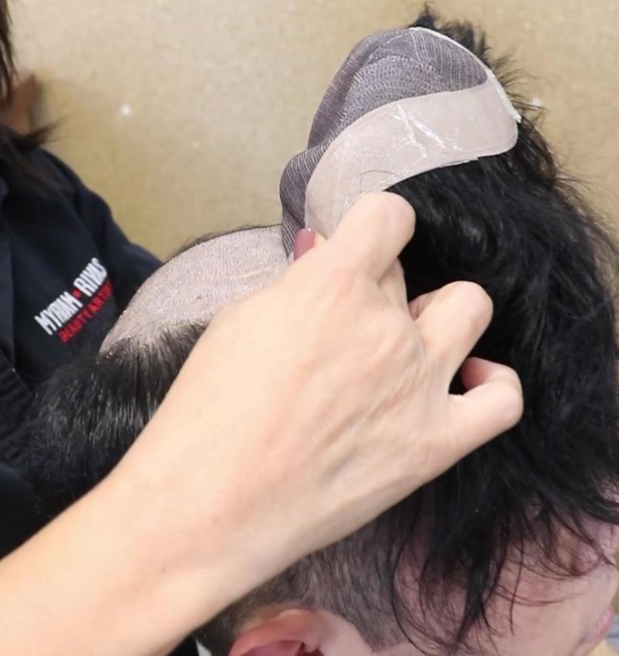 Prótesis capilar profesional para hombres